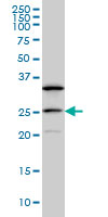 DCAKD Antibody - DCAKD monoclonal antibody (M02), clone 3E4 Western blot of DCAKD expression in MCF-7.