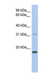 DCAL1 / CLECL1 Antibody - CLECL1 antibody Western blot of Placenta lysate. This image was taken for the unconjugated form of this product. Other forms have not been tested.