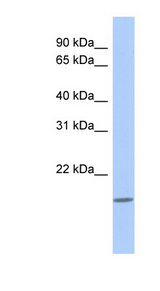 DCAL1 / CLECL1 Antibody - CLECL1 antibody Western blot of THP-1 cell lysate. This image was taken for the unconjugated form of this product. Other forms have not been tested.