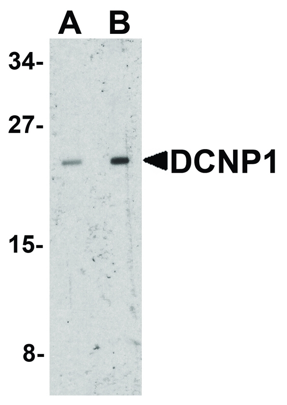 DCANP1 Antibody - Western blot analysis of DCNP1 in mouse skeletal muscle tissue lysate with DCNP1 antibody at (A) 1 and (B) 2 ug/ml.