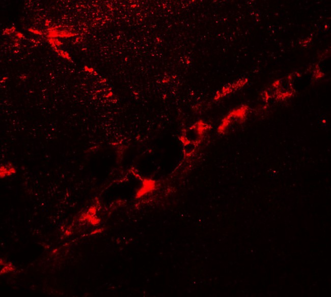 DCANP1 Antibody - Immunofluorescence of DCNP1 in mouse skeletal muscle tissue with DCNP1 antibody at 20 ug/ml.