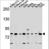 DCBLD2 Antibody - DCBLD2 Antibody western blot of mouse NIH-3T3,Neuro-2a cell line and mouse stomach tissue and U251,A2058,A375,Sk-Br-3,T47D cell line lysates (35 ug/lane). The DCBLD2 antibody detected the DCBLD2 protein (arrow).