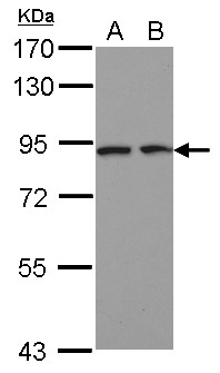 DCBLD2 Antibody - Sample (30 ug of whole cell lysate) A: HeLa B: HepG2 7.5% SDS PAGE DCBLD2 antibody diluted at 1:1000