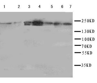 DCC Antibody - WB of DCC antibody. Lane 1: Rat Brain Tissue Lysate. Lane 2: Mouse Brain Tissue Lysate. Lane 3: U87 Cell Lysate. Lane 4: SW620 Cell Lysate. Lane 5: COLO320 Cell Lysate. Lane 6: 293T Cell Lysate. Lane 7: HELA Cell Lysate.