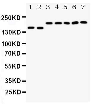 DCC Antibody - Anti-DCC antibody, Western blotting Lane 1: Rat Brain Tissue LysateLane 2: Mouse Brain Tissue LysateLane 3: U87 Cell LysateLane 4: SW620 Cell LysateLane 5: COLO320 Cell LysateLane 6: 293T Cell LysateLane 7: HELA Cell Lysate