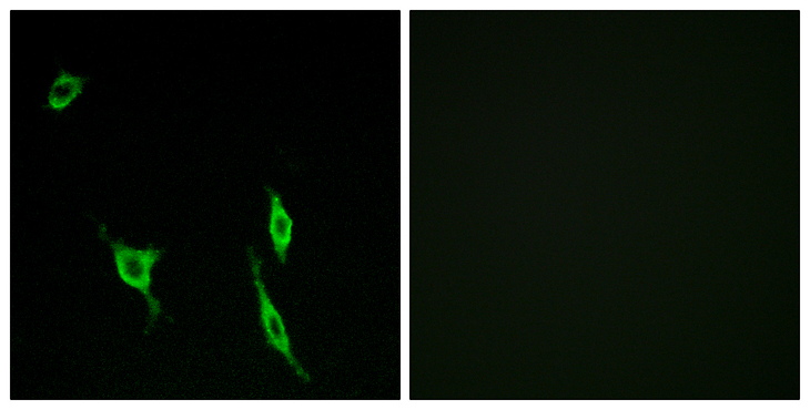 DCC Antibody - Immunofluorescence analysis of LOVO cells, using DCC Antibody. The picture on the right is blocked with the synthesized peptide.