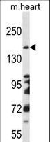 DCC Antibody - DCC Antibody western blot of mouse heart tissue lysates (35 ug/lane). The DCC antibody detected the DCC protein (arrow).