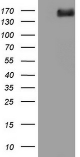 DCC Antibody - HEK293T cells were transfected with the pCMV6-ENTRY control. (Left lane) or pCMV6-ENTRY DCC. (Right lane) cDNA for 48 hrs and lysed. Equivalent amounts of cell lysates. (5 ug per lane) were separated by SDS-PAGE and immunoblotted with anti-DCC.