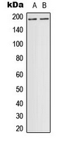 DCC Antibody - Western blot analysis of DCC expression in ACHN (A) whole cell lysates.