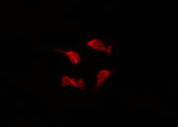 DCC Antibody - Staining HepG2 cells by IF/ICC. The samples were fixed with PFA and permeabilized in 0.1% Triton X-100, then blocked in 10% serum for 45 min at 25°C. The primary antibody was diluted at 1:200 and incubated with the sample for 1 hour at 37°C. An Alexa Fluor 594 conjugated goat anti-rabbit IgG (H+L) Ab, diluted at 1/600, was used as the secondary antibody.