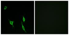 DCC Antibody - Peptide - + Immunofluorescence analysis of LOVO cells, using DCC antibody.