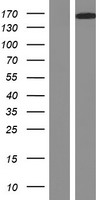 DCC Protein - Western validation with an anti-DDK antibody * L: Control HEK293 lysate R: Over-expression lysate