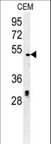 DCC1 / DSCC1 Antibody - DCC1 Antibody western blot of CEM cell line lysates (35 ug/lane). The DCC1 antibody detected the DCC1 protein (arrow).