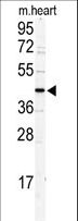 DCC1 / DSCC1 Antibody - Western blot of DCC1 antibody in mouse heart tissue lysates (35 ug/lane). DCC1 (arrow) was detected using the purified antibody.