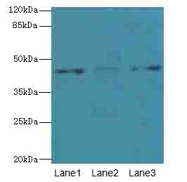DCC1 / DSCC1 Antibody - Western blot. All lanes: DSCC1 antibody at 8 ug/ml. Lane 1: CEM whole cell lysate. Lane 2: HeLa whole cell lysate. Lane 3: A431 whole cell lysate. Secondary Goat polyclonal to Rabbit IgG at 1:10000 dilution. Predicted band size: 45 kDa. Observed band size: 45 kDa.