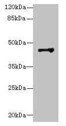DCC1 / DSCC1 Antibody - Western blot All lanes: DSCC1 antibody at 8µg/ml + CEM whole cell lysate Secondary Goat polyclonal to rabbit IgG at 1/10000 dilution Predicted band size: 45 kDa Observed band size: 45 kDa
