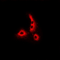 DCD / Dermcidin Antibody - Immunofluorescent analysis of Dermcidin staining in MCF7 cells. Formalin-fixed cells were permeabilized with 0.1% Triton X-100 in TBS for 5-10 minutes and blocked with 3% BSA-PBS for 30 minutes at room temperature. Cells were probed with the primary antibody in 3% BSA-PBS and incubated overnight at 4 deg C in a humidified chamber. Cells were washed with PBST and incubated with a DyLight 594-conjugated secondary antibody (red) in PBS at room temperature in the dark.