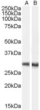 DCDC2 Antibody - Staining of mouse brain lysate (35 ug protein in RIPA buffer) with A) Goat Anti-Dcdc2a Antibody (EB07463) (0.1 ug/ml) and B) LS-B10286. Primary incubation was 1 hour. Detected by chemiluminescence.