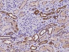 DCDC2 Antibody - Immunochemical staining of human DCDC2 in human kidney with rabbit polyclonal antibody at 1:500 dilution, formalin-fixed paraffin embedded sections.