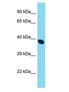 DCDC2B Antibody - DCDC2B antibody Western Blot of HepG2. Antibody dilution: 1 ug/ml.  This image was taken for the unconjugated form of this product. Other forms have not been tested.
