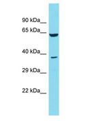 DCDC2B Antibody - DCDC2B antibody Western Blot of HeLa. Antibody dilution: 1 ug/ml.  This image was taken for the unconjugated form of this product. Other forms have not been tested.