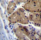 DCDC5 Antibody - DCDC5 Antibody immunohistochemistry of formalin-fixed and paraffin-embedded human stomach tissue followed by peroxidase-conjugated secondary antibody and DAB staining.