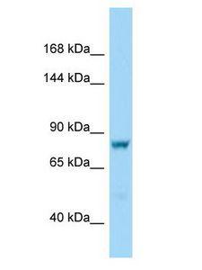 DCDC5 Antibody - DCDC5 antibody Western Blot of HeLa. Antibody dilution: 1 ug/ml.  This image was taken for the unconjugated form of this product. Other forms have not been tested.