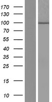 DCDC5 Protein - Western validation with an anti-DDK antibody * L: Control HEK293 lysate R: Over-expression lysate