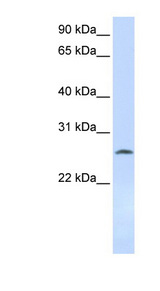 DCK / Deoxycytidine kinase Antibody - DCK antibody Western blot of 721_B cell lysate. This image was taken for the unconjugated form of this product. Other forms have not been tested.