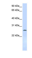 DCK / Deoxycytidine kinase Antibody - DCK antibody Western blot of 721_B cell lysate. This image was taken for the unconjugated form of this product. Other forms have not been tested.