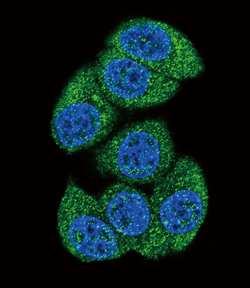 DCK / Deoxycytidine kinase Antibody - Confocal immunofluorescence of DCK Antibody with HeLa cell followed by Alexa Fluor 488-conjugated goat anti-rabbit lgG (green). DAPI was used to stain the cell nuclear (blue).