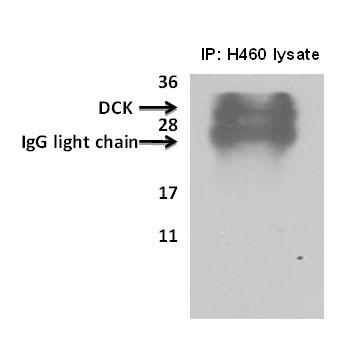 DCK / Deoxycytidine kinase Antibody - Deoxycytidine kinase(DCK) immunoprecipitated from H460cells with 7.5ug (microgram) of the dCK antibody using the Pierce classic mammalian IP kit (#45217) reagent as described as manufacturer instructions (lane 1, 3) and Current Protocols in Cell Biology, 1998, 7.2.1-7.2.21. Proteins separated on a 12% SDS gel, transferred to a PVDF membrane and probed with 1:700 dilution of DCK antibody. Bands were detected using enhanced chemiluminescence (SuperSignal West Pico Chemiluminescent Substrate Kit). No specific reagents were employed to remove IgG from immunoprecipitated sample. Data courtesy of Dr. Stacy Shord, University of Illinois, Chicago.