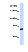 DCK / Deoxycytidine kinase Antibody - DCK antibody Western blot of Fetal Heart lysate. This image was taken for the unconjugated form of this product. Other forms have not been tested.