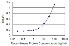 DCK / Deoxycytidine kinase Antibody - Detection limit for recombinant GST tagged DCK is 0.3 ng/ml as a capture antibody.