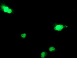DCK / Deoxycytidine kinase Antibody - Anti-DCK mouse monoclonal antibody immunofluorescent staining of COS7 cells transiently transfected by pCMV6-ENTRY DCK.