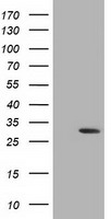 DCK / Deoxycytidine kinase Antibody - HEK293T cells were transfected with the pCMV6-ENTRY control (Left lane) or pCMV6-ENTRY DCK (Right lane) cDNA for 48 hrs and lysed. Equivalent amounts of cell lysates (5 ug per lane) were separated by SDS-PAGE and immunoblotted with anti-DCK.