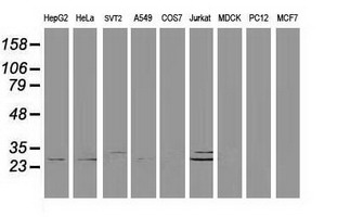 DCK / Deoxycytidine kinase Antibody - Western blot of extracts (35 ug) from 9 different cell lines by using anti-DCK monoclonal antibody (HepG2: human; HeLa: human; SVT2: mouse; A549: human; COS7: monkey; Jurkat: human; MDCK: canine; PC12: rat; MCF7: human).