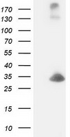 DCK / Deoxycytidine kinase Antibody - HEK293T cells were transfected with the pCMV6-ENTRY control (Left lane) or pCMV6-ENTRY DCK (Right lane) cDNA for 48 hrs and lysed. Equivalent amounts of cell lysates (5 ug per lane) were separated by SDS-PAGE and immunoblotted with anti-DCK.