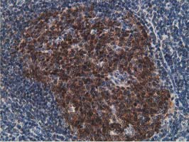 DCK / Deoxycytidine kinase Antibody - IHC of paraffin-embedded Human lymph node tissue using anti-DCK mouse monoclonal antibody.