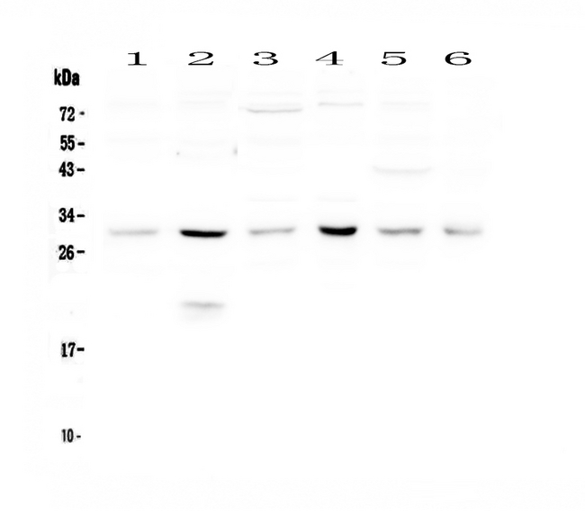 DCK / Deoxycytidine kinase Antibody - Western blot - Anti-DCK Picoband antibody