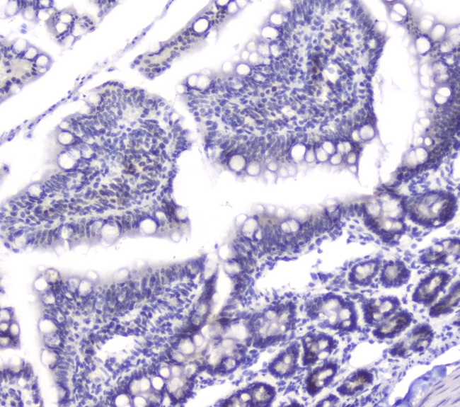 DCK / Deoxycytidine kinase Antibody - IHC analysis of DCK using anti-DCK antibody. DCK was detected in paraffin-embedded section of rat small intestine tissues. Heat mediated antigen retrieval was performed in citrate buffer (pH6, epitope retrieval solution) for 20 mins. The tissue section was blocked with 10% goat serum. The tissue section was then incubated with 1µg/ml rabbit anti-DCK Antibody overnight at 4°C. Biotinylated goat anti-rabbit IgG was used as secondary antibody and incubated for 30 minutes at 37°C. The tissue section was developed using Strepavidin-Biotin-Complex (SABC) with DAB as the chromogen.