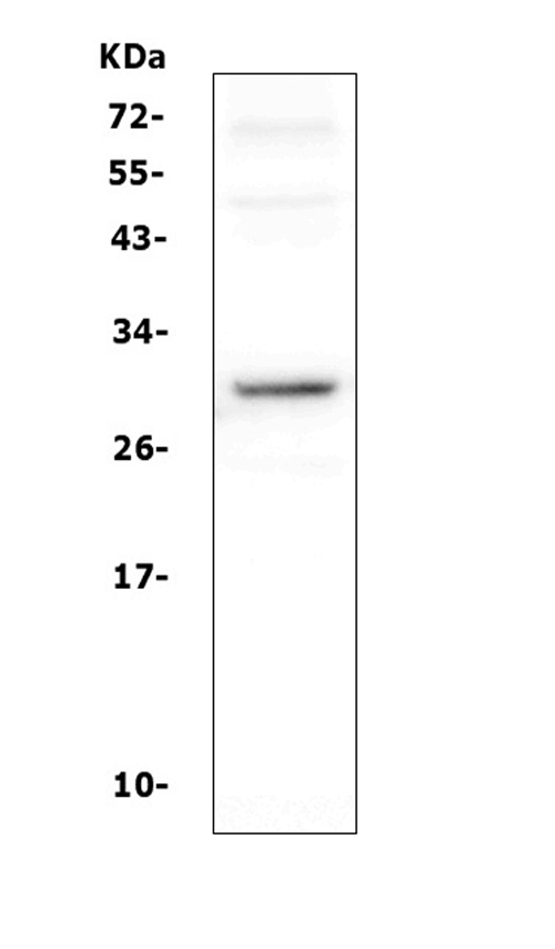 DCK / Deoxycytidine kinase Antibody - Western blot analysis of DCK using anti-DCK antibody. Electrophoresis was performed on a 5-20% SDS-PAGE gel at 70V (Stacking gel) / 90V (Resolving gel) for 2-3 hours. The sample well of each lane was loaded with 50ug of sample under reducing conditions. Lane 1: rat thymus tissue lysates. After Electrophoresis, proteins were transferred to a Nitrocellulose membrane at 150mA for 50-90 minutes. Blocked the membrane with 5% Non-fat Milk/ TBS for 1.5 hour at RT. The membrane was incubated with rabbit anti-DCK antigen affinity purified polyclonal antibody at 0.5 µg/mL overnight at 4°C, then washed with TBS-0.1% Tween 3 times with 5 minutes each and probed with a goat anti-rabbit IgG-HRP secondary antibody at a dilution of 1:10000 for 1.5 hour at RT. The signal is developed using an Enhanced Chemiluminescent detection (ECL) kit with Tanon 5200 system. A specific band was detected for DCK at approximately 30KD. The expected band size for DCK is at 30KD.