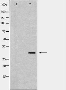 DCK / Deoxycytidine kinase Antibody - Western blot analysis of extracts of WiDr using DCK antibody. The lane on the left is treated with the antigen-specific peptide.