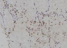 DCK / Deoxycytidine kinase Antibody - 1:100 staining human lung tissue by IHC-P. The sample was formaldehyde fixed and a heat mediated antigen retrieval step in citrate buffer was performed. The sample was then blocked and incubated with the antibody for 1.5 hours at 22°C. An HRP conjugated goat anti-rabbit antibody was used as the secondary.