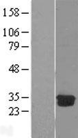 DCK / Deoxycytidine kinase Protein - Western validation with an anti-DDK antibody * L: Control HEK293 lysate R: Over-expression lysate