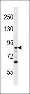 DCLK / DCLK1 Antibody - DCAMKL1 Antibody (D13) western blot of T47D cell line lysates (35 ug/lane). The DCAMKL1 antibody detected the DCAMKL1 protein (arrow).