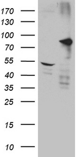DCLK / DCLK1 Antibody - HEK293T cells were transfected with the pCMV6-ENTRY control. (Left lane) or pCMV6-ENTRY DCLK1. (Right lane) cDNA for 48 hrs and lysed. Equivalent amounts of cell lysates. (5 ug per lane) were separated by SDS-PAGE and immunoblotted with anti-DCLK1. (1:2000)
