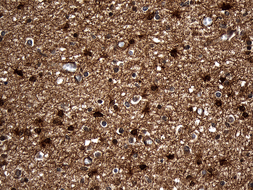 DCLK / DCLK1 Antibody - Immunohistochemical staining of paraffin-embedded Human embryonic cerebellum within the normal limits using anti-DCLK1 mouse monoclonal antibody. (Heat-induced epitope retrieval by 1mM EDTA in 10mM Tris buffer. (pH8.5) at 120°C for 3 min. (1:500).
