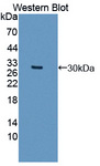 DCLK / DCLK1 Antibody - Western blot of DCLK / DCLK1 antibody.