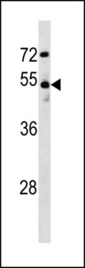 DCLK / DCLK1 Antibody - DCLK1 Antibody western blot of MDA-MB231 cell line lysates (35 ug/lane). The DCLK1 antibody detected the DCLK1 protein (arrow).